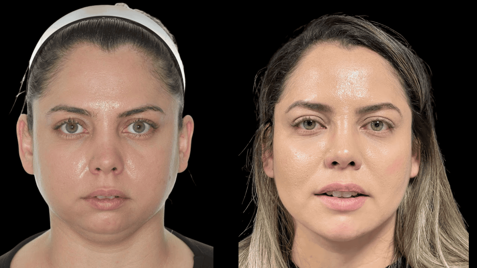 Antes e depois