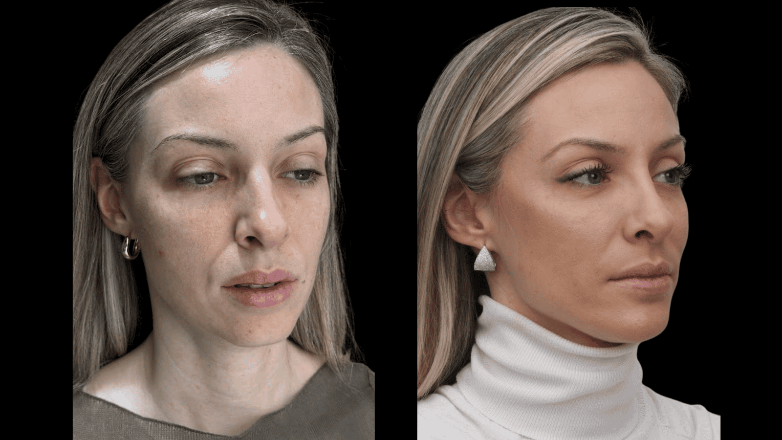Antes e depois