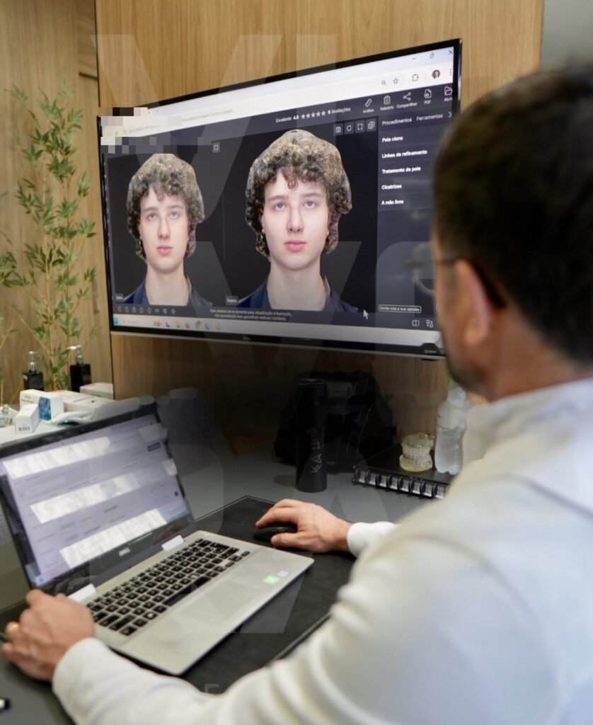 avaliação com simulação facial 3D na Vivera Orofacial em Florianópolis