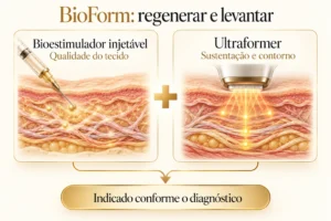 BioForm: bioestimulador injetável associado ao Ultraformer para regenerar e levantar o rosto